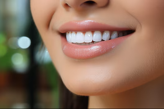 Clareamento dental: mitos e verdades